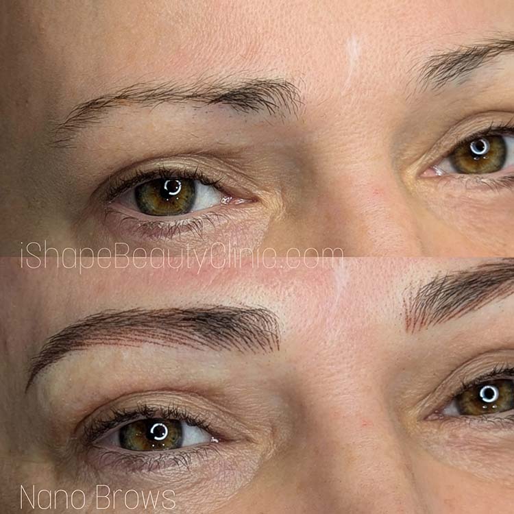 Nano brows done at our iShapeBrows clinic here in Las Vegas